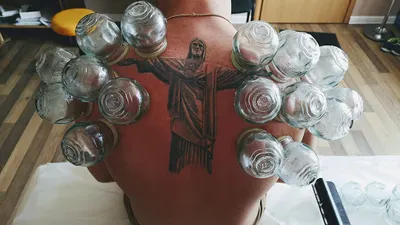 FIZJOSTREFA ANDERMED